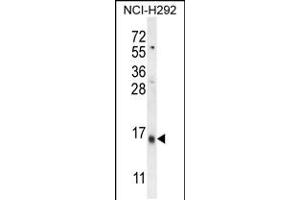 Western blot analysis in NCI-H292 cell line lysates (35ug/lane). (LY6G6C Antikörper  (C-Term))