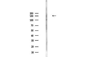 Western blot analysis of lysates from PC12 cells(UV,30 min treatment), using Phospho-PLCG1 (Tyr783) Antibody at 1/1000 dilution.