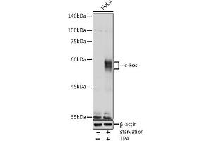 Western blot analysis of extracts of HeLa cells, using c-Fos antibody (ABIN3020747, ABIN3020748, ABIN3020749, ABIN1512925 and ABIN6213704) at 1:1000 dilution. (c-FOS Antikörper  (AA 211-380))