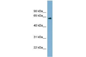 WB Suggested Anti-C12orf4 Antibody Titration: 0. (C12orf4 Antikörper  (Middle Region))