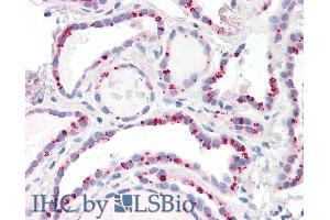 Immunohistochemistry (IHC) image for anti-Protein Phosphatase 2, Catalytic Subunit, beta Isozyme (PPP2CB) (C-Term) antibody (ABIN184646)