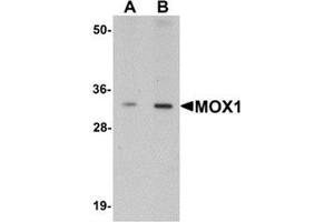 Western blot analysis of MOX1 in human liver tissue lysate with MOX1 antibody at (A) 1 and (B) 2 μg/ml. (MEOX1 Antikörper  (Center))
