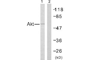 Western blot analysis of the extracts from Jurkat cells using Akt (Ab-308) antibody (#B7005). (AKT1 Antikörper  (Thr308))