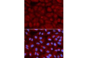Immunofluorescence (IF) image for anti-Bridging Integrator 1 (BIN1) antibody (ABIN1871291) (BIN1 Antikörper)
