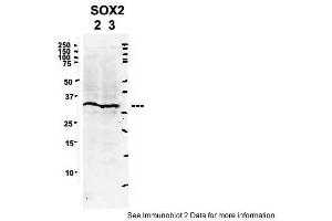 Sample Type: 2. (SOX2 Antikörper  (Middle Region))