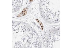 Immunohistochemical staining of human testis with GBP6 polyclonal antibody  shows strong cytoplasmic positivity in Leydig cells.
