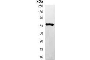 Immunoprecipitation of His-tagged protein from HEK293T cells transfected with vector overexpressing His tag, using Anti-His-tag Antibody. (His Tag Antikörper)