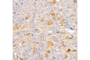 Immunohistochemistry (Paraffin-embedded Sections) (IHC (p)) image for anti-Adhesion Molecule with Ig-Like Domain 2 (AMIGO2) antibody (ABIN7072966)