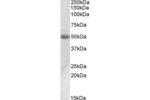 AP31101PU-N ACPP antibody staining of Human Prostate lysate at 0. (ACPP Antikörper  (Internal Region))
