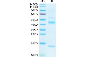 Biotinylated Human Latent TGF beta 1 on Tris-Bis PAGE under reduced condition. (Latent TGF-beta 1 (AA 30-390) protein (His-Avi Tag,Biotin))