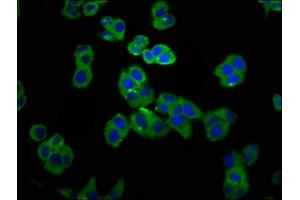 Immunofluorescence staining of PC-3 cells with ABIN7153683 at 1:100, counter-stained with DAPI.