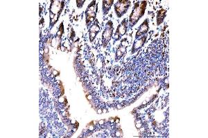 IHC analysis of MSK2/RSK-B/RPS6KA4 using anti-MSK2/RSK-B/RPS6KA4 antibody (ABIN7601238).