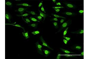 Immunofluorescence of purified MaxPab antibody to ALOX5 on HeLa cell.