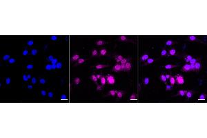 Immunocytochemical staining of HeLa cells with Sestrin 1 antibody (ABIN7800321), 1:1,000).