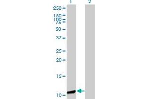 Western Blot analysis of GTF2A2 expression in transfected 293T cell line by GTF2A2 monoclonal antibody (M01), clone 2B9.