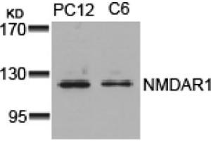 Image no. 1 for anti-NMDA Receptor 1 (NMDA R1) (AA 894-898) antibody (ABIN319312) (NMDA 1 Receptor Antikörper  (AA 894-898))