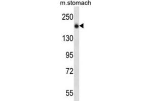 Western Blotting (WB) image for anti-Unc-13 Homolog B (UNC13B) antibody (ABIN2997152) (UNC13B Antikörper)
