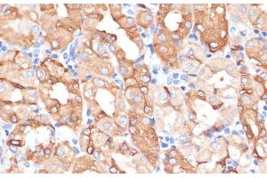 Immunohistochemistry of paraffin-embedded Human stomach using NHLRC1 Polyclonal Antibody at dilution of 1:100 (40x lens). (NHLRC1 Antikörper)