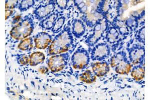 ABIN6256933 and ABIN6274579 at 1/100 staining Mouse colorectal tissue by IHC-P. (ADCY4 Antikörper  (Internal Region))