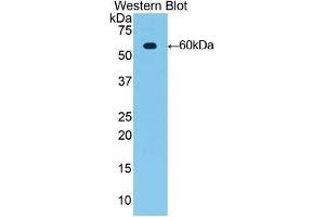 Detection of Recombinant MUC1, Rat using Polyclonal Antibody to Mucin 1 (MUC1) (MUC1 Antikörper  (AA 404-655))