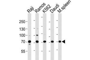 Western blot analysis of lysate from Raji, Ramos, K562, Daudi cell line and mouse spleen tissue lysate using BTK antibody at 1:1000. (BTK Antikörper  (AA 396-430))
