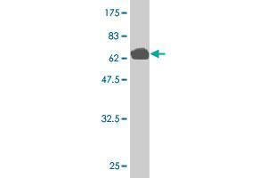 Western Blot detection against Immunogen (76. (MLLT6 Antikörper  (AA 1-462))