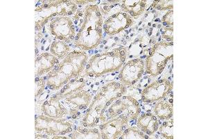 Immunohistochemistry of paraffin-embedded rat kidney using RNF166 antibody. (RNF166 Antikörper)