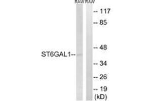 Western blot analysis of extracts from RAW264. (ST6GAL1 Antikörper  (AA 171-220))