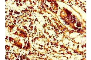 Immunohistochemistry of paraffin-embedded human appendix tissue using ABIN7170841 at dilution of 1:100 (SMAP1 Antikörper  (AA 1-280))
