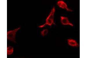 ABIN6274195 staining RAW264. (TNFRSF1B Antikörper  (C-Term))