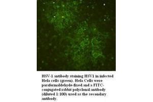 Image no. 1 for anti-Herpes Simplex Virus Type 1 (HSV1) antibody (ABIN791168) (Herpes Simplex Virus Type 1 (HSV1) Antikörper)