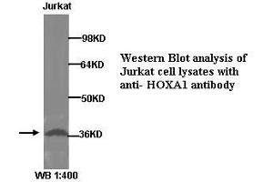 Image no. 1 for anti-Homeobox A1 (HOXA1) (Internal Region) antibody (ABIN790933) (HOXA1 Antikörper  (Internal Region))