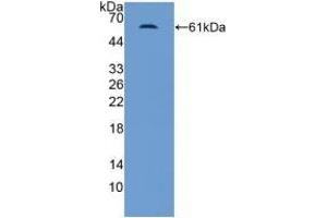 Western Blotting (WB) image for anti-Nuclear Receptor Subfamily 3, Group C, Member 2 (NR3C2) (AA 739-984) antibody (ABIN7431818)