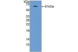 Detection of Recombinant MR, Human using Polyclonal Antibody to Mineralocorticoid Receptor (MR)