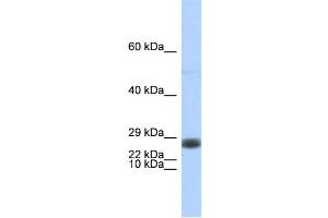WB Suggested Anti-EDF1 Antibody Titration:  0. (EDF1 Antikörper  (Middle Region))