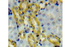 Used in DAB staining on fromalin fixed paraffin-embedded Kidney tissue (ALDH1A3 Antikörper  (AA 332-509))