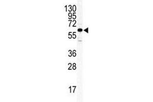 Western blot analysis of ILK2/ILK1 antibody and HeLa lysate. (ILK Antikörper  (AA 391-421))
