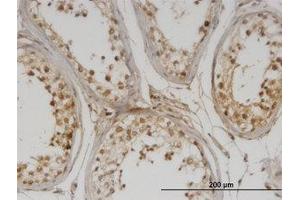 Image no. 1 for anti-DNA Methyltransferase 1-Associated Protein 1 (DMAP1) (AA 1-101) antibody (ABIN599578) (DMAP1 Antikörper  (AA 1-101))