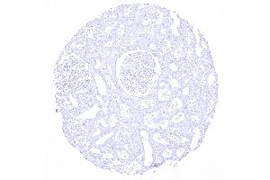 kidney cortex (Rekombinanter KRT20 Antikörper  (AA 196-323))