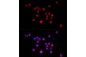 Immunofluorescence analysis of Neuro-2a cells using Nestin Rabbit pAb (ABIN6128335, ABIN6144536, ABIN6144537 and ABIN6215496) at dilution of 1:50 (40x lens). (Nestin Antikörper  (AA 1392-1621))