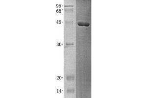 Western Blotting (WB) image for 4-Hydroxyphenylpyruvate Dioxygenase (HPD) (Transcript Variant 2) protein (His tag) (ABIN2723013)