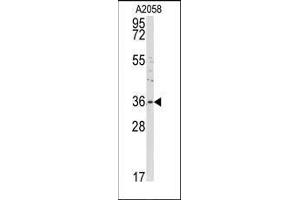 Western blot analysis of anti-ANXA2 Antibody (C-term) in A2058 cell line lysates (35ug/lane).