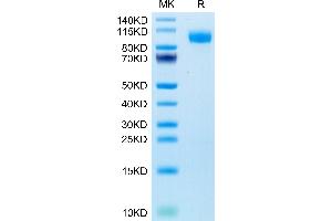 Human EGFR/HER1 on Tris-Bis PAGE under reduced condition. (EGFR Protein (AA 25-645) (His-Avi Tag))