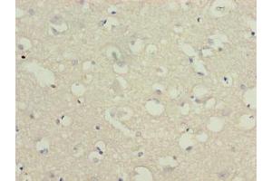 Immunohistochemistry of paraffin-embedded human brain tissue using ABIN7174836 at dilution of 1:100 (C3orf18 Antikörper  (AA 83-162))