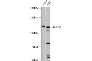 Western blot analysis of extracts of various cell lines, using NLRP12 antibody (ABIN7268938) at 1:3000 dilution. (NLRP12 Antikörper  (AA 862-1062))