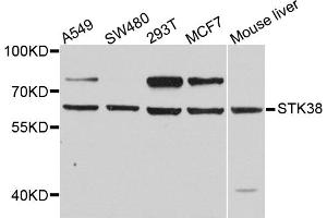Western blot analysis of extracts of various cell lines, using STK38 antibody (ABIN5974655) at 1/1000 dilution. (STK38 Antikörper)