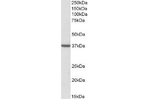 ABIN2560487 (2µg/ml) staining of Human Frontal Cortex lysate (35µg protein in RIPA buffer). (TOMM40 Antikörper  (Internal Region))