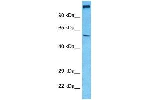 Western Blotting (WB) image for anti-Solute Carrier Family 17 (Vesicular Glutamate Transporter), Member 7 (SLC17A7) (N-Term) antibody (ABIN5671386)