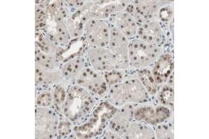 Immunohistochemical staining of human kidney with LONP2 polyclonal antibody  shows strong nuclear and weak cytoplasmic positivity in cells in tubules. (LONP2 Antikörper)