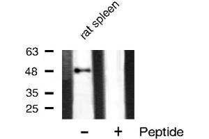 Western blot analysis of GATA3 phosphorylation expression in rat spleen tissue lysates,The lane on the right is treated with the antigen-specific peptide.
